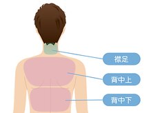 ボス 名古屋 天白店(BOSS)/【メンズ脱毛/上半身背面】#脱毛