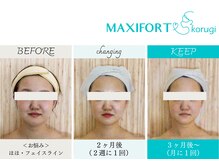 コルギ専門店 マキシフォート 栄店(Maxifort)/お客さまからの感想