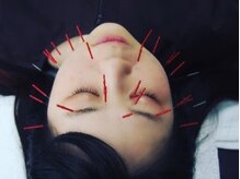 はりつばさ