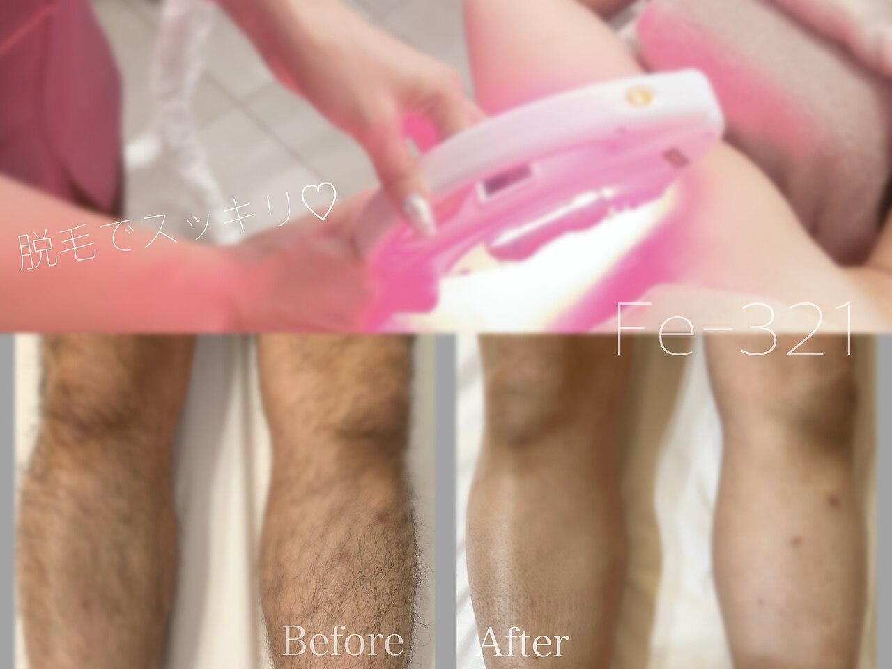 エフイーサンニーイチ(Fe-321)｜ホットペッパービューティー