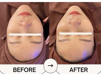 ハーゼ(Hase)/LDM/水玉トリプルリフティング