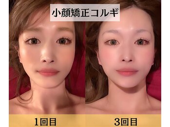 スイスパ(翠SUI SPA)