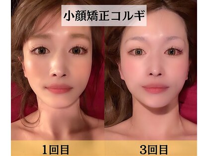 スイスパ(翠SUI SPA)の写真