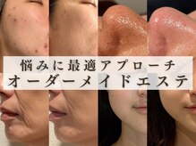 ラノン(LANON)