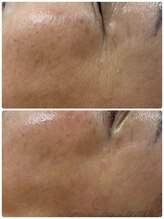 ルーメ(lume)/50代女性