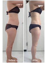 クレビア(Clevia)/Clevia-クレビア-