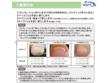 エヌエープラスネイル 葛西本店(Na+nail)/巻き爪ケア