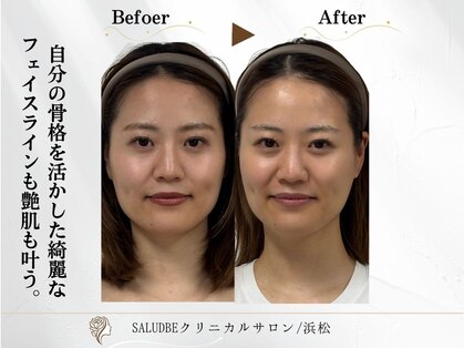 サリューベ(SALUDBE)の写真
