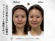 サリューベ(SALUDBE)の写真