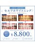 《2回目～都度利用》美白セルフホワイトニング40分照射￥8,800