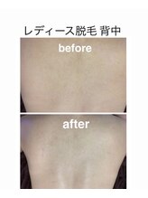 アオドットアール(Ao.r)/全身ムラなくお任せください♪