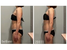 ドゥ ボーテ(de beaute)/de beaute