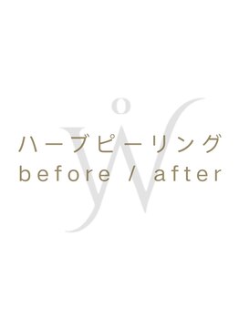 ウォーマル(warmaL)/