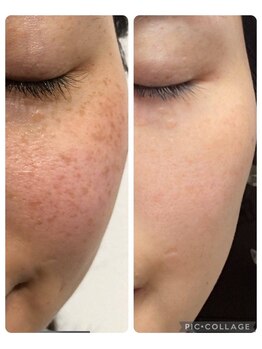 ゆう/内服だけの効果です！