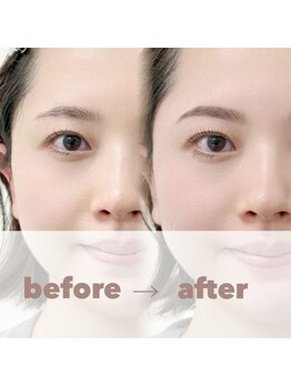 リンク(LINK)/l i n k