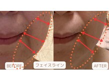 ブーケ/フェイスラインすっきり♪