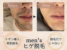 ミモア(mimoi.)