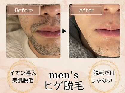 ミモア(mimoi.)の写真