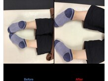 ストレチックス 近江八幡店/ストレッチ　ビフォーアフター