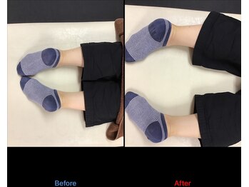 ストレチックス 近江八幡店/ストレッチ ビフォーアフター