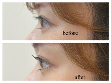 ブレス セルバテラス泉店(BLESS)/上下パーマ