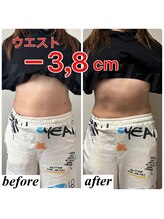 ハリシカ鍼灸院/なんと1回の施術で－3.8cm