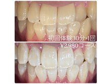 ホワイトニングルーム 横浜店(Whitening Room)/セルフホワイトニング/横浜