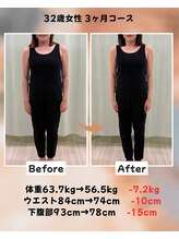 くさば整骨院/32歳女性/ダイエット3か月コース