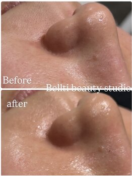 ベルティ(Bellti)/潤いを与えよう