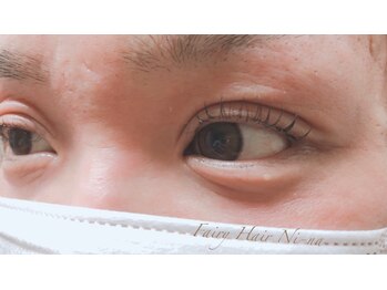 フェアリーヘア ニーナ(Fairy Hair Ni-na)/まつ毛パーマ【ラッシュリフト】