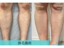 リメイククリニカルビューティー(Remake clinical beauty)/メンズ脱毛