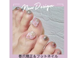 巻爪ケア
