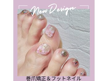 巻爪ケア