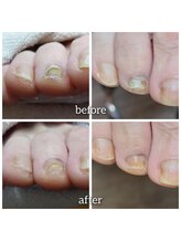 爪切り屋 足楽/