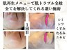 2回目以降【全ての肌悩みに】シリカ微細針ピーリング 60分 33000→29700