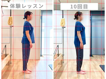 ウェルフィット 北18条店(Welfit)/ピラティス/ビフォーアフター
