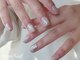 ブレスネイル(brace Nail)の写真