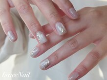ブレスネイル(brace Nail)