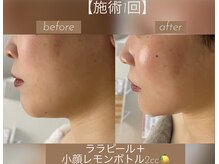 ザ サロン 726(THE SALON 726)の雰囲気（【美肌フェイシャル＆ボディトリートメント】100分で全身ケア！）