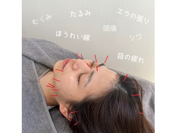 イン フィレーカ(in Filaka)