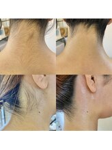 アロー(Allo!)/うなじ&オフショル