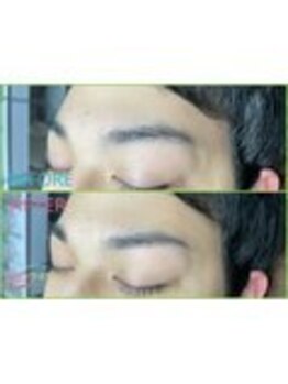 MDラボ 小松清六店/before after