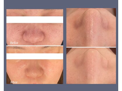 エノアビューティー(ENOA beauty)の写真