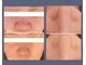 エノアビューティー(ENOA beauty)の写真