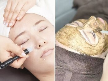 エイナミビューティサロンの写真/話題の「OHLハーブピーリング」で肌質改善ニキビケア★毛穴洗浄&吸引付きで黒ずみ・角質も綺麗に☆満足度◎