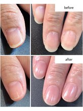 ケアプラス(care plus)/ハンドネイルケア