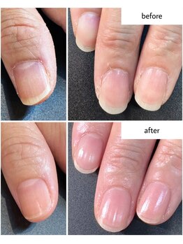 ケアプラス(care plus)/ハンドネイルケア