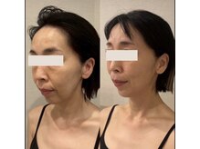 ドクターボディクリスタル(Dr.Body Crystal)/50代