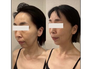 ドクターボディクリスタル(Dr.Body Crystal)/50代