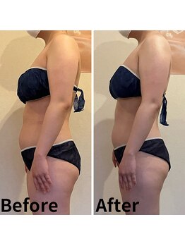 レヴェイユ/お客様Before→After